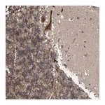 Atlas Antibodies Anti-ABHD13 Antibody