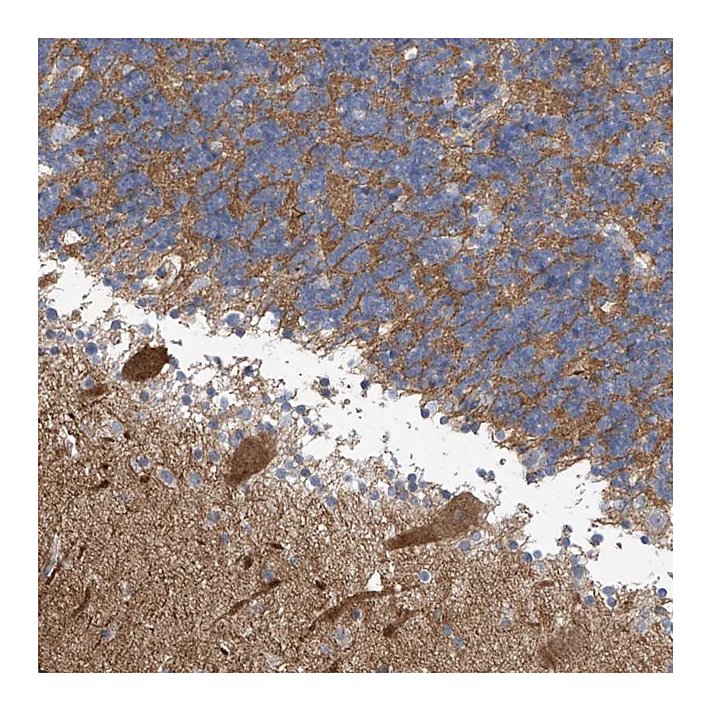 Atlas Antibodies Anti-ABHD13 Antibody