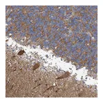 Atlas Antibodies Anti-ABHD13 Antibody