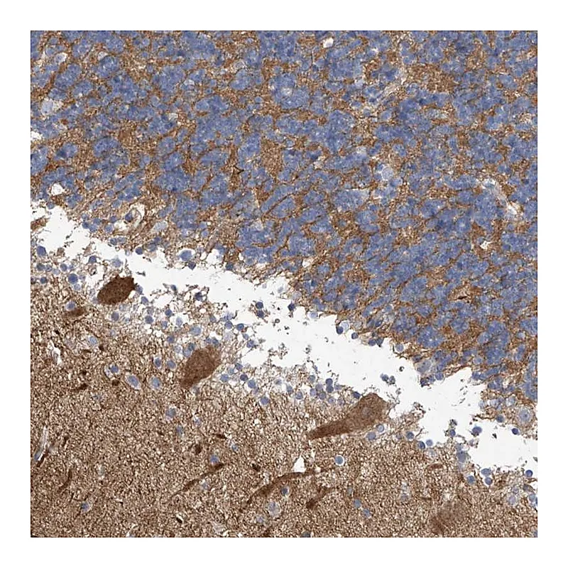 Atlas Antibodies Anti-ABHD13 Antibody