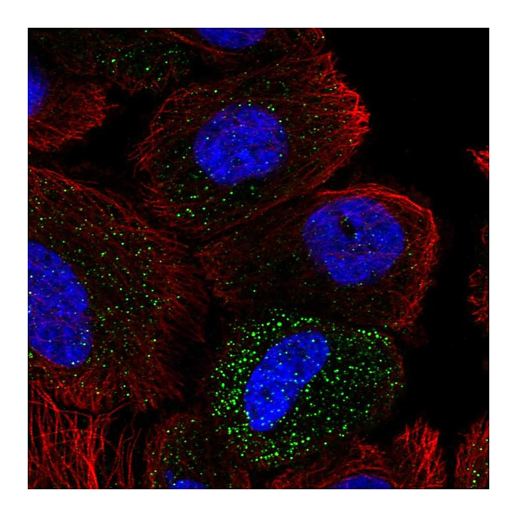 Atlas Antibodies Anti-ABHD14A Antibody