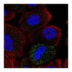 Atlas Antibodies Anti-ABHD14A Antibody