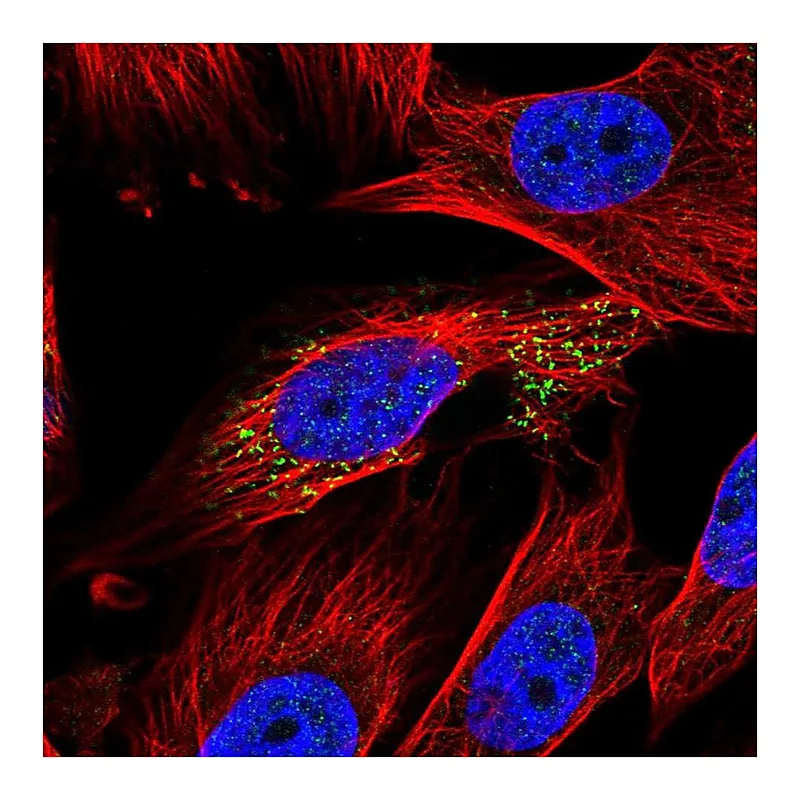 Atlas Antibodies Anti-ABHD14A Antibody