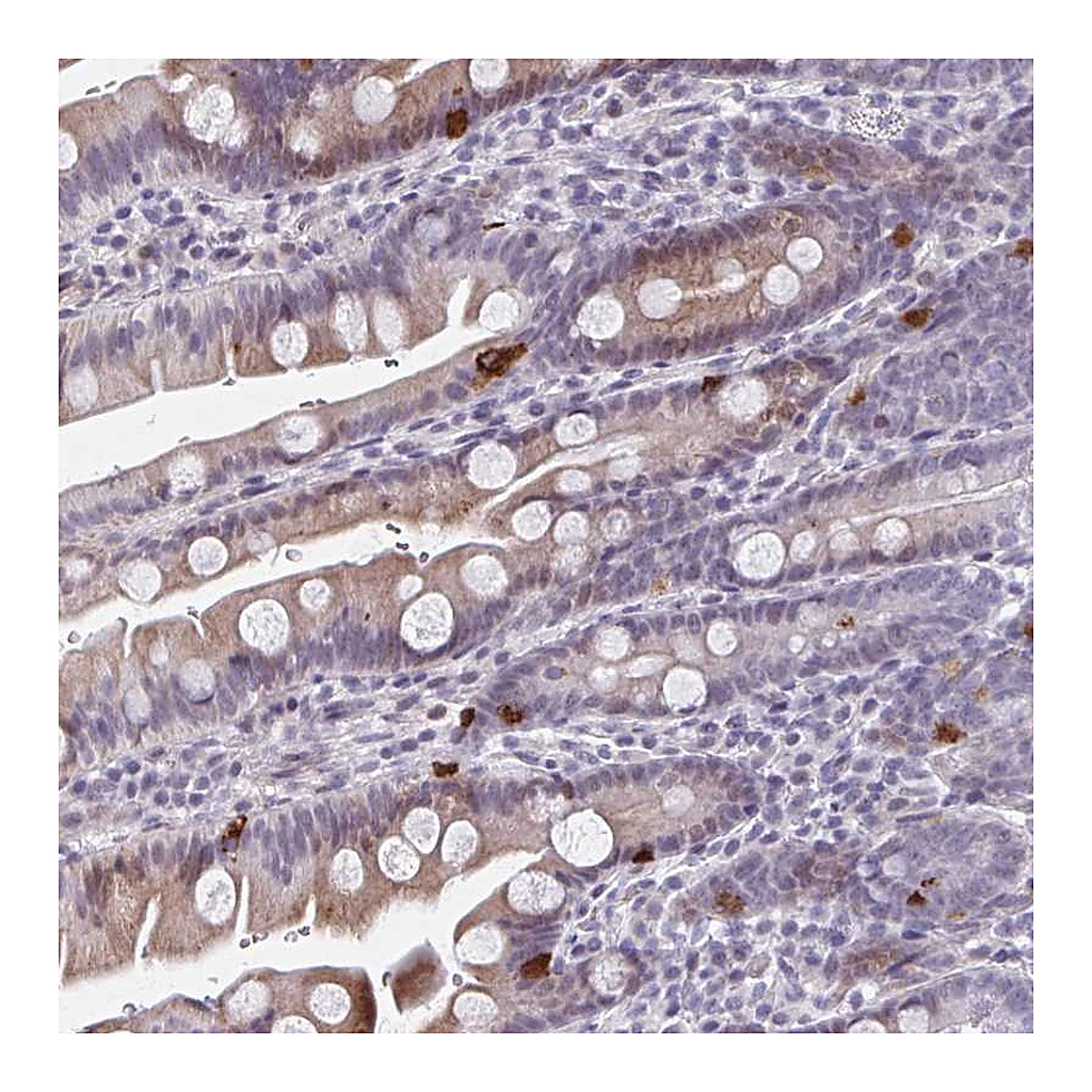 Atlas Antibodies Anti-ABHD16B Antibody