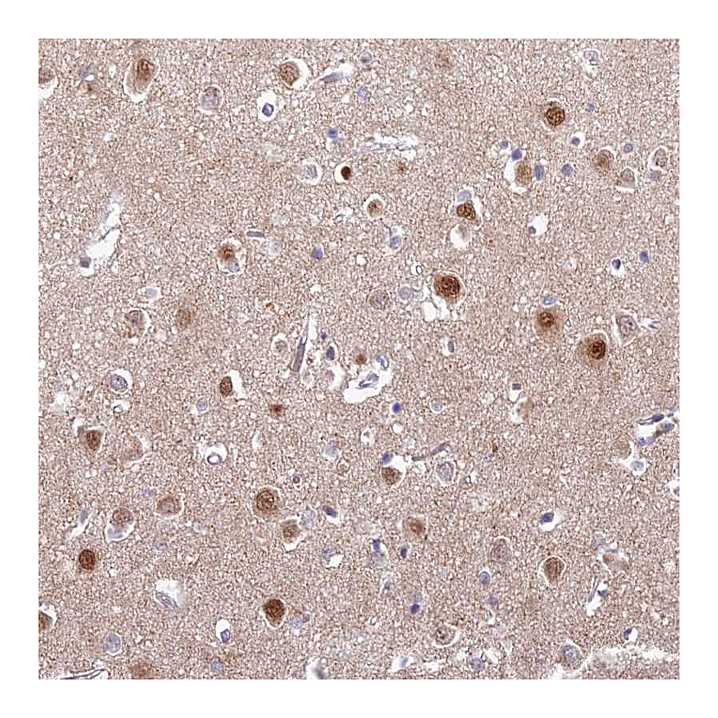 Atlas Antibodies Anti-ABHD17A Antibody