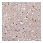 Atlas Antibodies Anti-ABHD17A Antibody