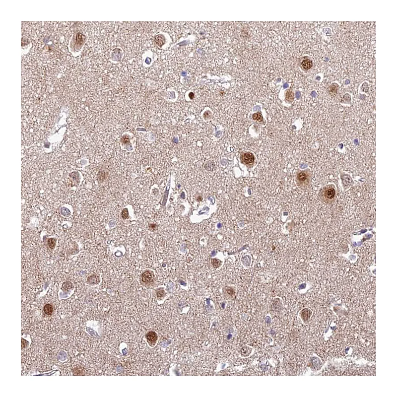 Atlas Antibodies Anti-ABHD17A Antibody