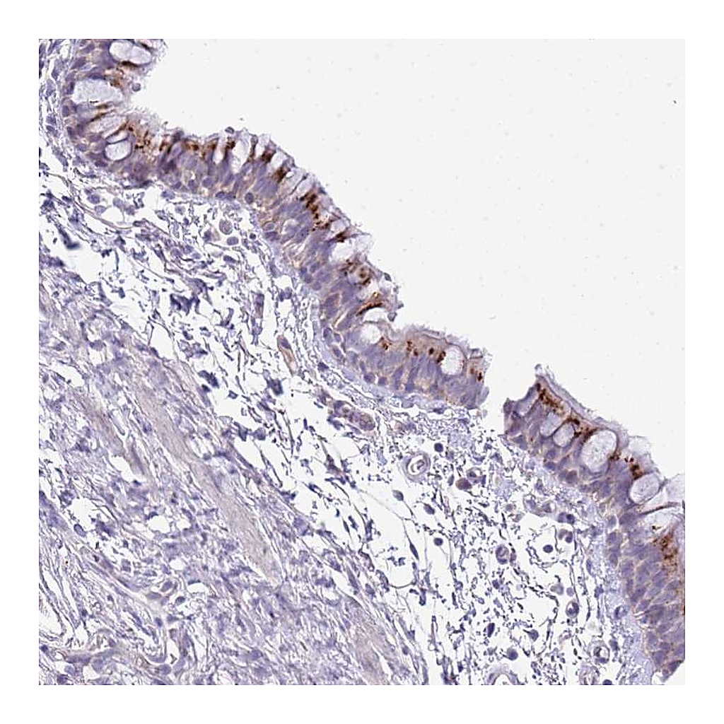 Atlas Antibodies Anti-ABHD17A Antibody