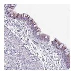 Atlas Antibodies Anti-ABHD17A Antibody