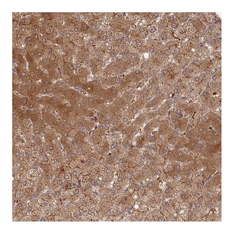 Atlas Antibodies Anti-ABHD14B Antibody