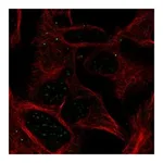 Atlas Antibodies Anti-ABHD17A Antibody