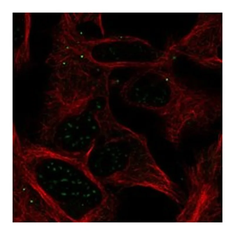 Atlas Antibodies Anti-ABHD17A Antibody