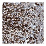 Atlas Antibodies Anti-ABHD18 Antibody