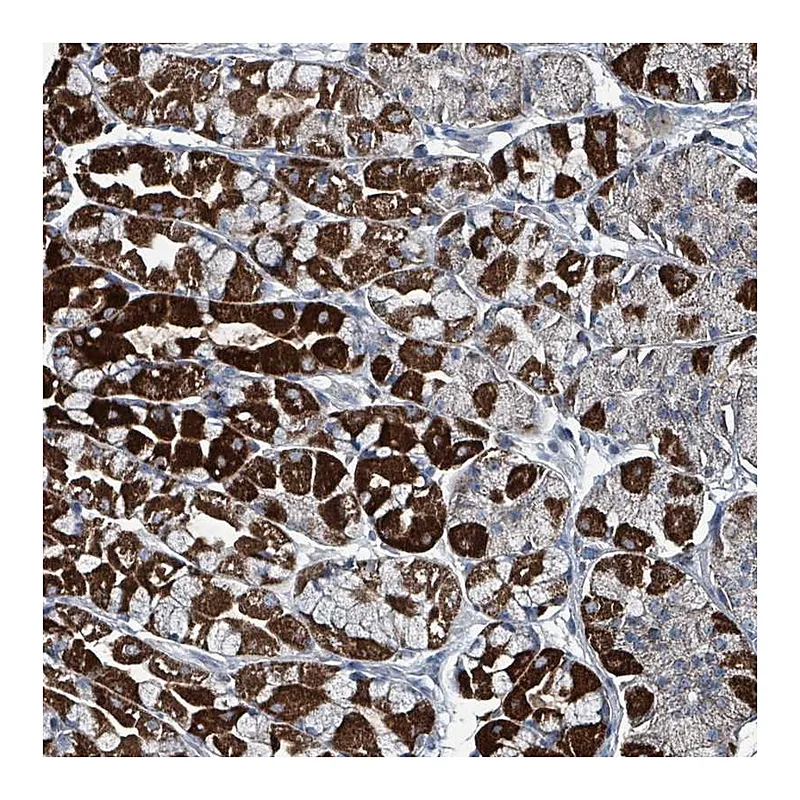 Atlas Antibodies Anti-ABHD18 Antibody