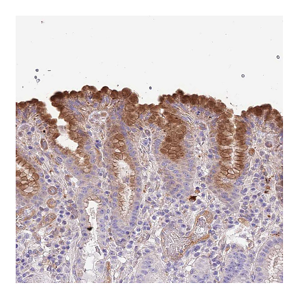 Atlas Antibodies Anti-ABHD17C Antibody
