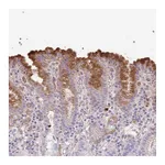 Atlas Antibodies Anti-ABHD17C Antibody