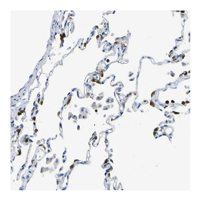Atlas Antibodies Anti-ABHD3 Antibody