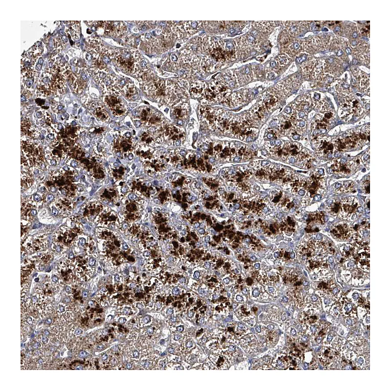 Atlas Antibodies Anti-ABHD18 Antibody