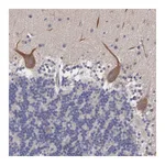 Atlas Antibodies Anti-ABHD4 Antibody