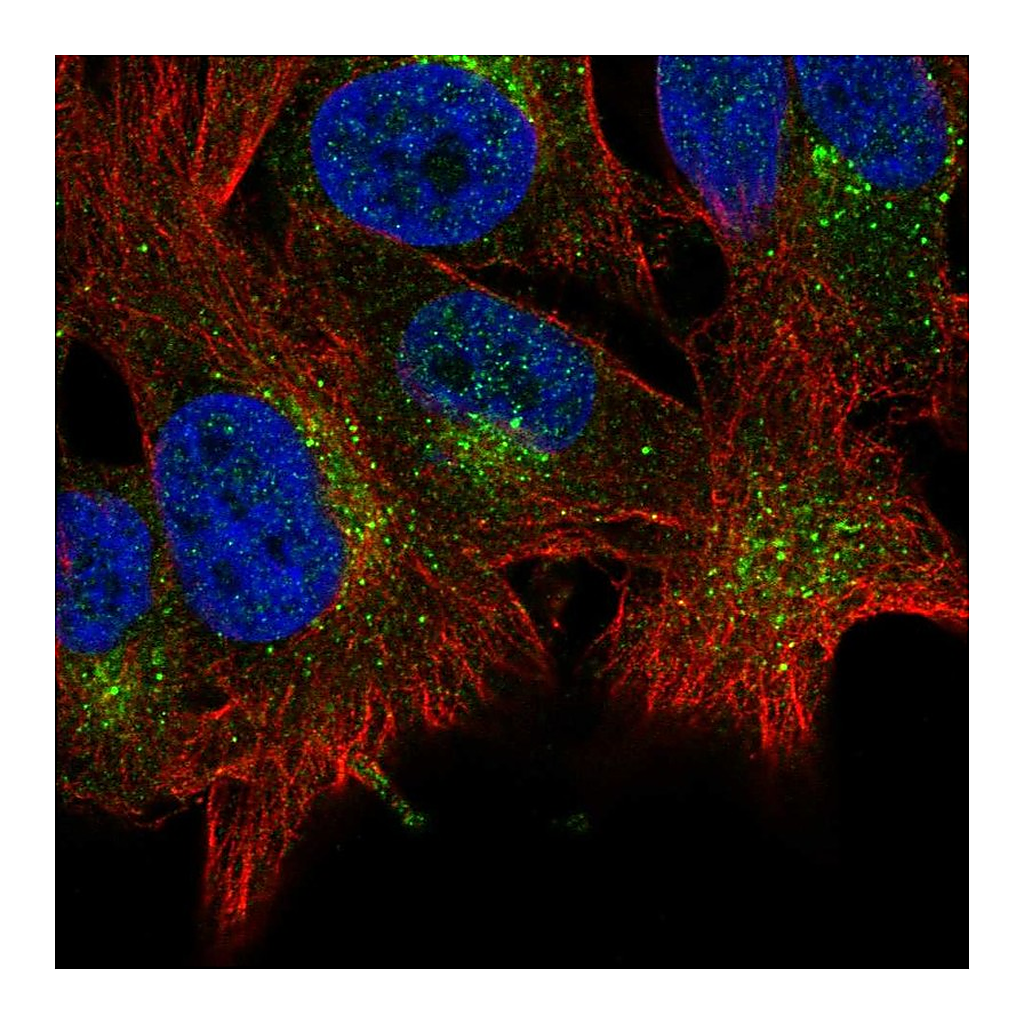 Atlas Antibodies Anti-ABHD6 Antibody