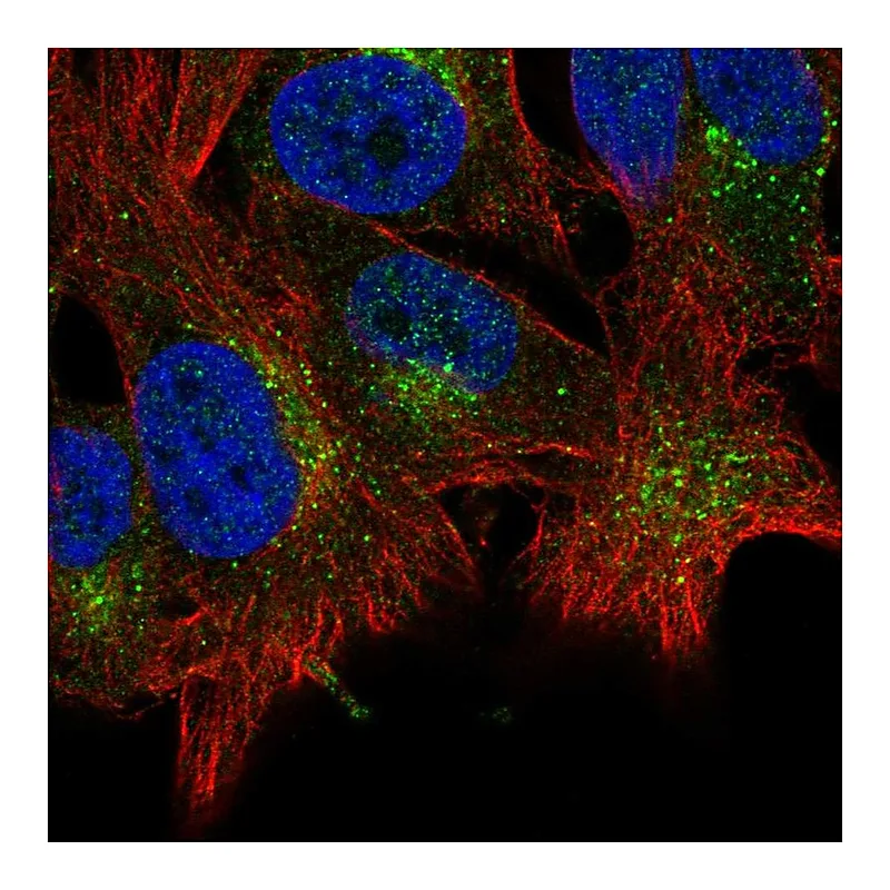 Atlas Antibodies Anti-ABHD6 Antibody
