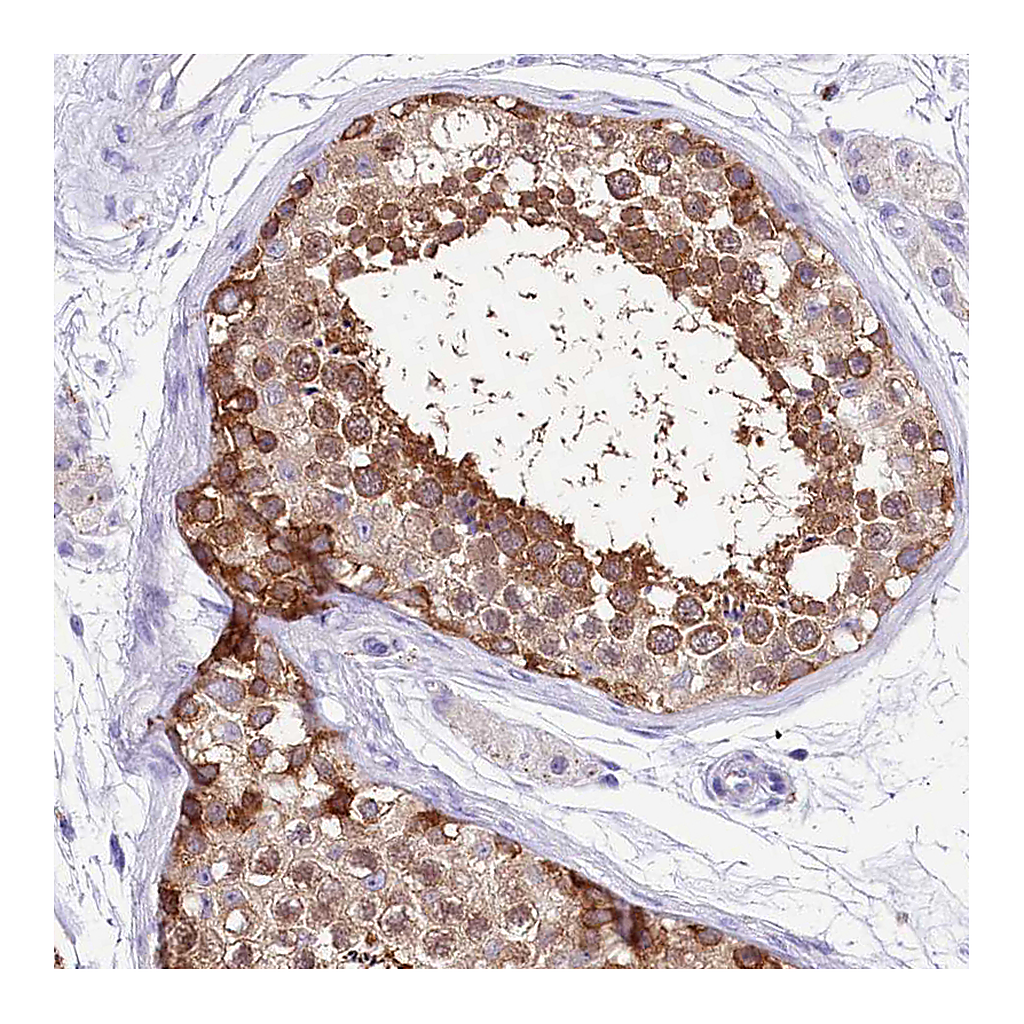 Atlas Antibodies Anti-ABHD5 Antibody