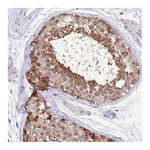Atlas Antibodies Anti-ABHD5 Antibody