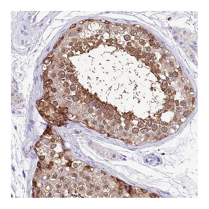 Atlas Antibodies Anti-ABHD5 Antibody