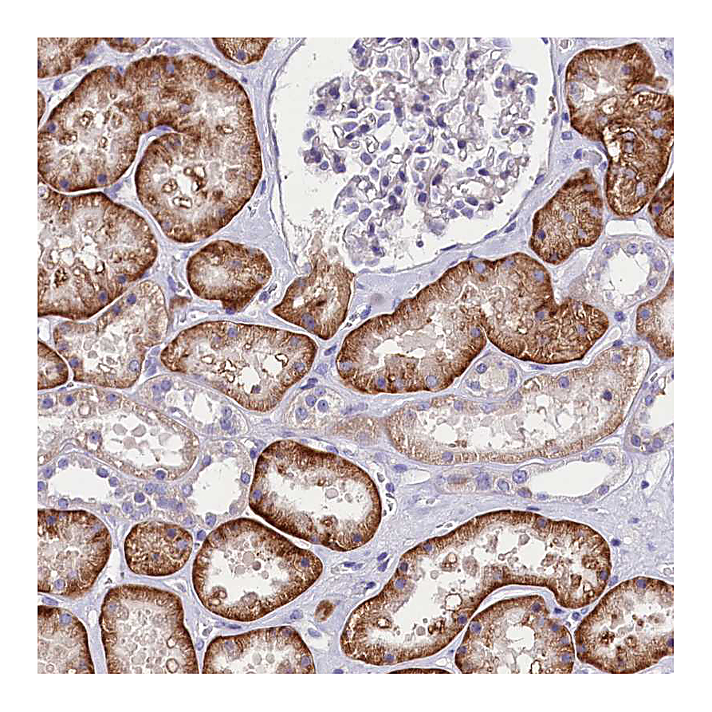 Atlas Antibodies Anti-ABHD5 Antibody
