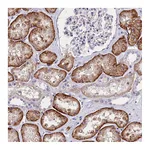 Atlas Antibodies Anti-ABHD5 Antibody