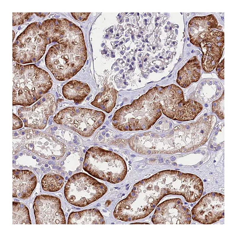 Atlas Antibodies Anti-ABHD5 Antibody