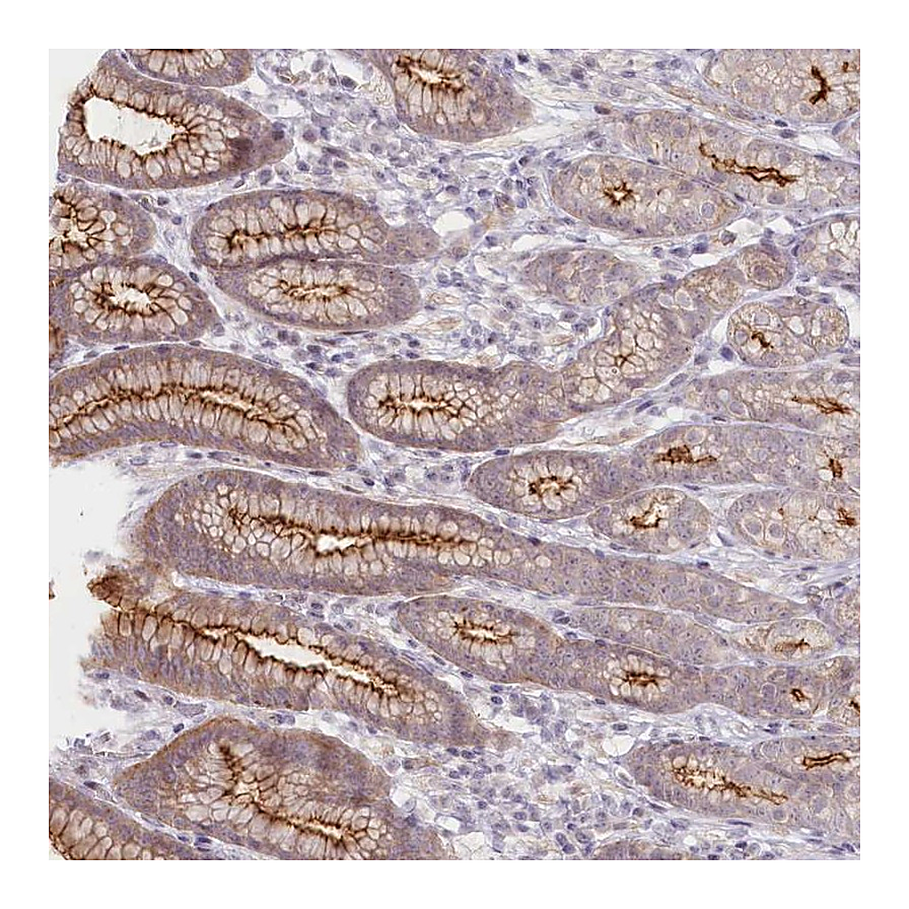 Atlas Antibodies Anti-ABHD8 Antibody