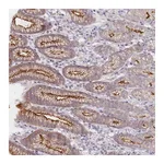 Atlas Antibodies Anti-ABHD8 Antibody