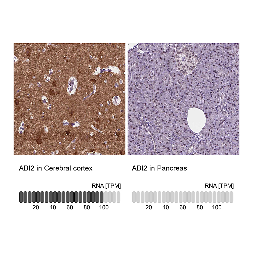 Atlas Antibodies Anti-ABI2 Antibody