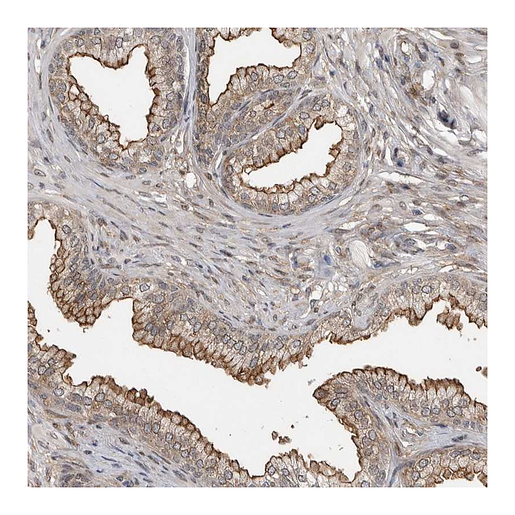 Atlas Antibodies Anti-ABL1 Antibody