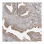 Atlas Antibodies Anti-ABL1 Antibody