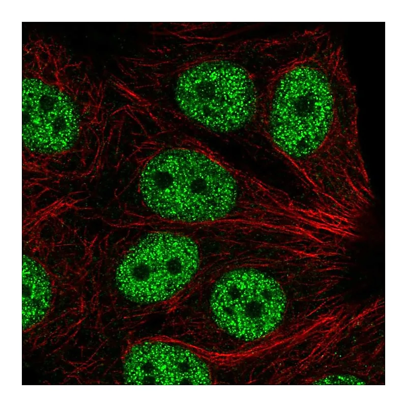 Atlas Antibodies Anti-ABI2 Antibody