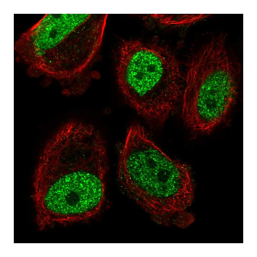 Atlas Antibodies Anti-ABHD8 Antibody