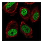 Atlas Antibodies Anti-ABHD8 Antibody
