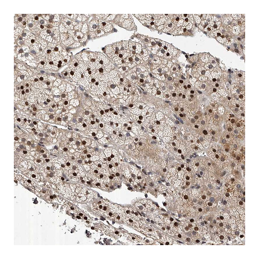 Atlas Antibodies Anti-ABL1 Antibody
