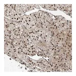 Atlas Antibodies Anti-ABL1 Antibody