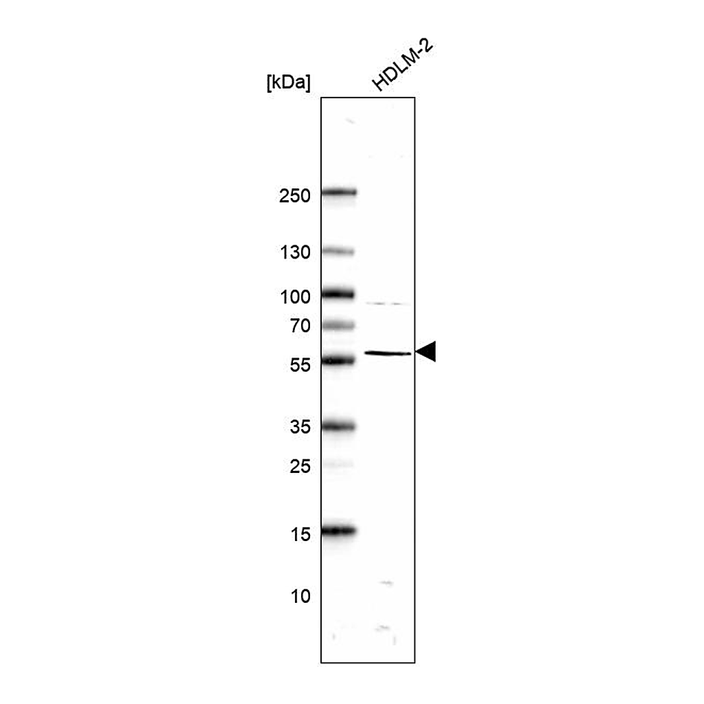 Atlas Antibodies Anti-ABI1 Antibody