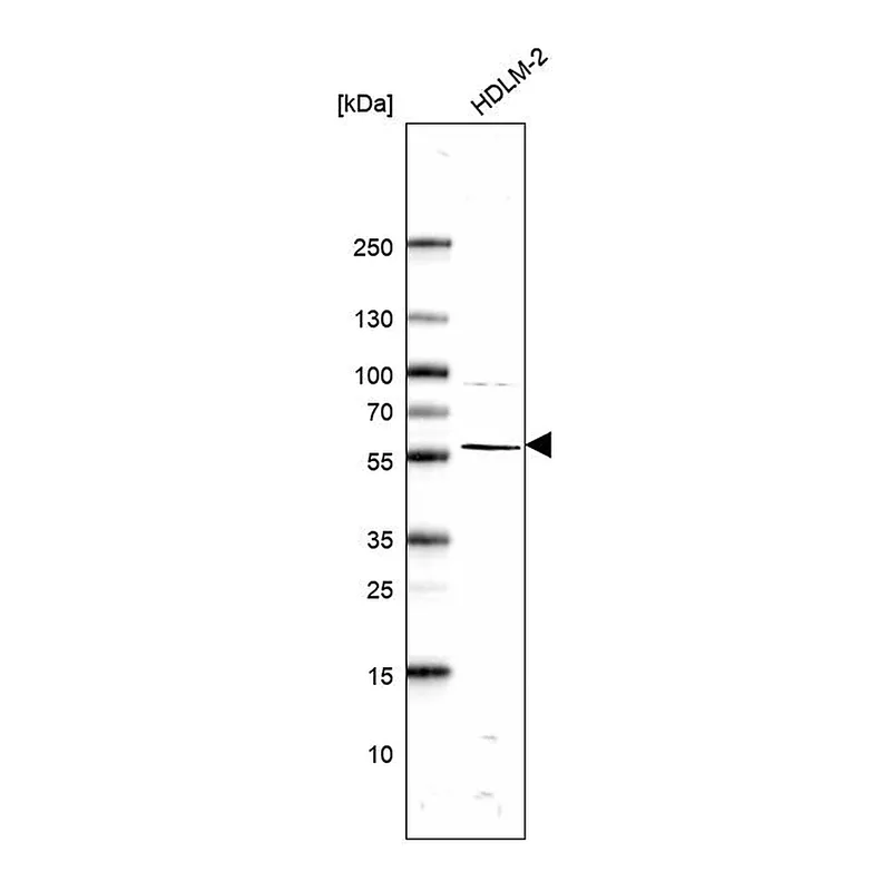 Atlas Antibodies Anti-ABI1 Antibody