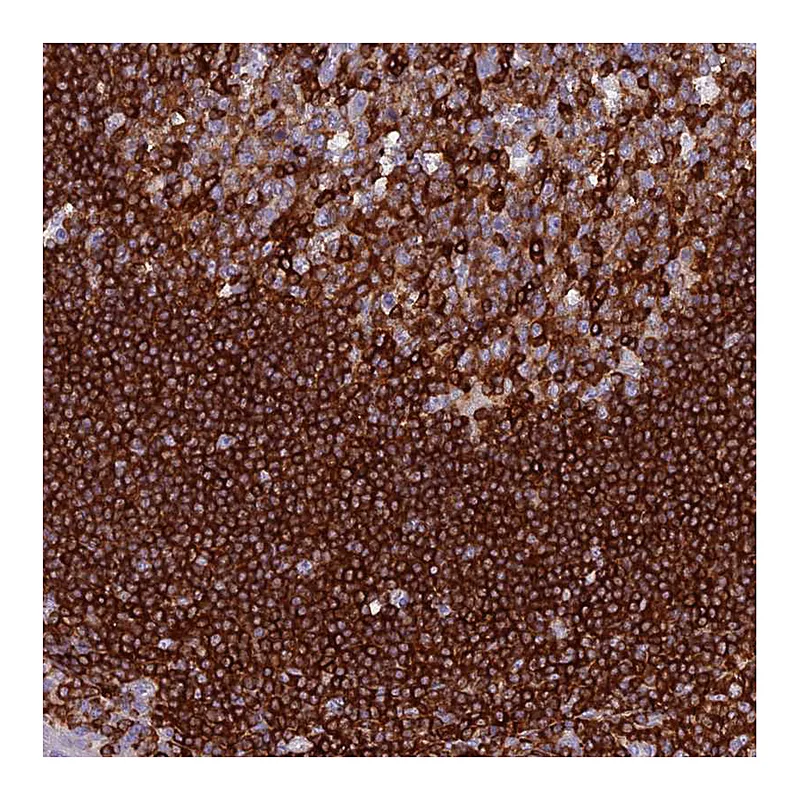 Atlas Antibodies Anti-ABI3BP Antibody