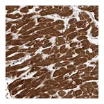 Atlas Antibodies Anti-ABL1 Antibody