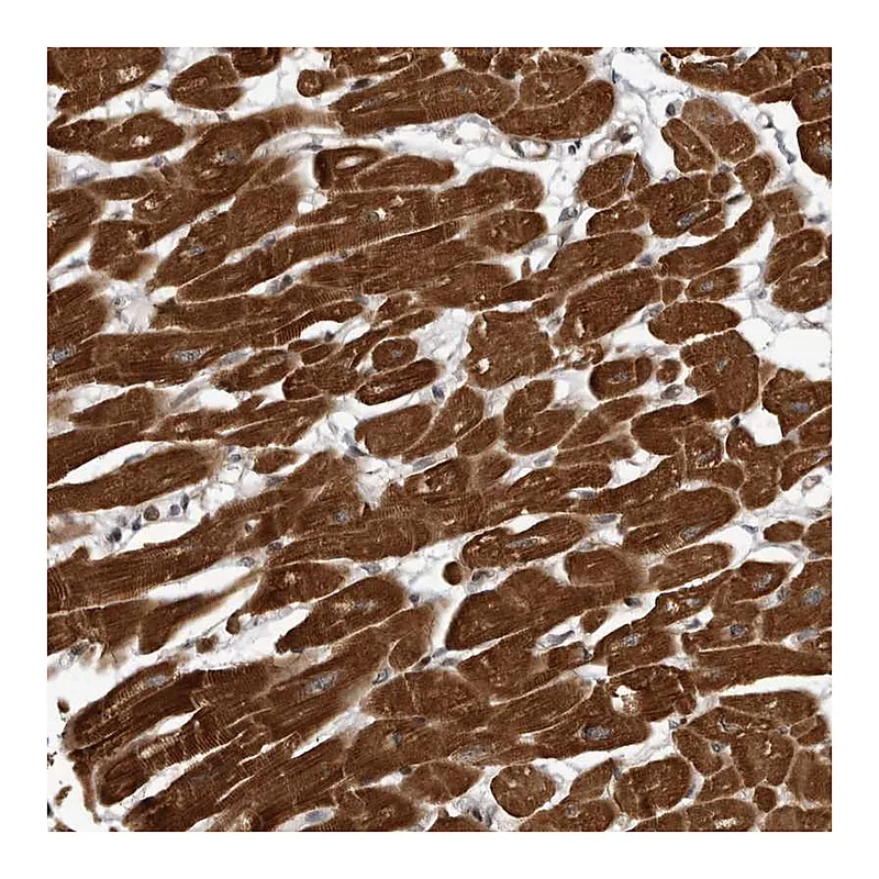 Atlas Antibodies Anti-ABL1 Antibody