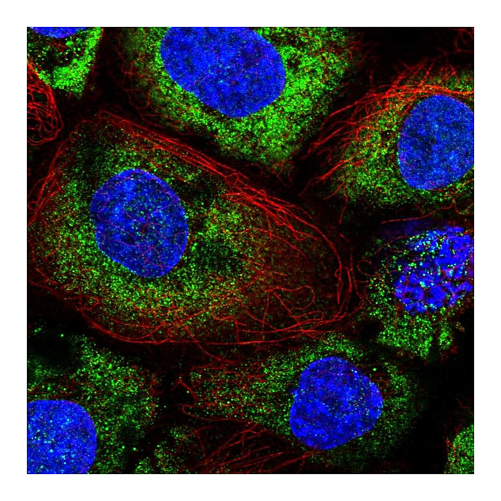 Atlas Antibodies Anti-ABR Antibody