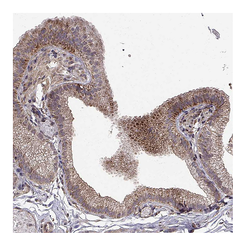 Atlas Antibodies Anti-ABL2 Antibody