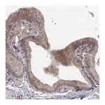 Atlas Antibodies Anti-ABL2 Antibody