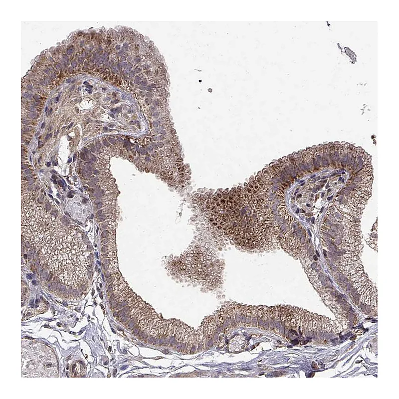 Atlas Antibodies Anti-ABL2 Antibody